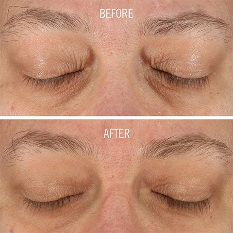 Before and After model shot