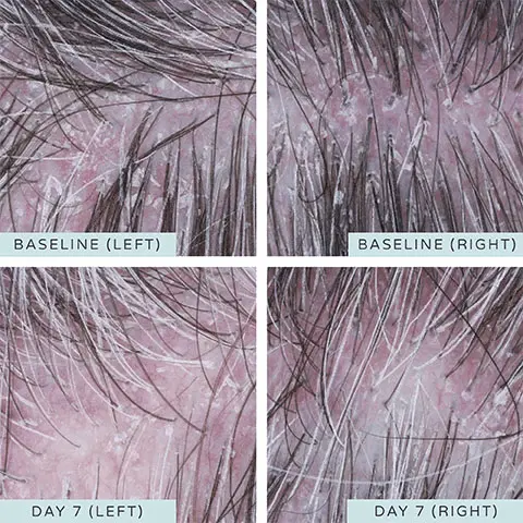 Before and After 7 days