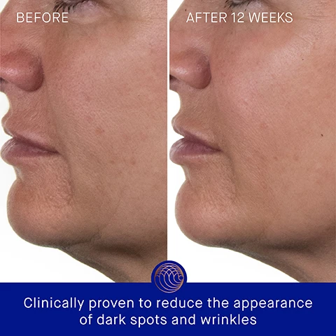 Image 3 - Image shows a side-by-side comparison of a persons face with the left side labeled Before and the right side labeled After 12 Weeks, demonstrating a noticeable improvement in skin appearance with reduced wrinkles; additional text at the bottom states Clinically proven to reduce the appearance of dark spots and wrinkles.
Image 4 - A blue bottle of Augustinus Baders The Rich Cream is shown, with text stating Clinically Proven Results, Skin hydration is improved by 2.4x, Skin firmness and elasticity are improved by 36%, The appearance of forehead wrinkles visibly reduced by 37%, and a note about a 4-week Clinical Trial of 30 participants.
Image 5 - Image of a skincare product, a blue bottle of Augustinus Baders The Rich Cream with a copper lid, accompanied by text highlighting user feedback: 100% agree skin feels instantly hydrated and nourished, 100% agree complexion looks plump and replenished, 95% agree the appearance of fine lines/wrinkles is dramatically improved, with a note about a consumer perception study.
Image 6 - A skincare bottle labeled Augustinus Bader The Rich Cream with blue and gold design, surrounded by descriptions of ingredients and benefits such as TFC8, Evening Primrose Oil, Argan Oil, and Hyaluronic Acid, highlighting properties like skin elasticity and hydration.
Image 7 - Image shows two skincare products side by side, titled The Cream and The Rich Cream, with each product featuring a bottle design, descriptions of texture, key benefits, key concerns, and ideal skin types; visible text includes descriptions such as A lightweight daily moisturizer and A luxuriously rich daily moisturizer.
Image 8 - A layout of a skincare routine featuring four numbered steps with product images: 1. Cleanse - THE CREAM CLEANSING GEL; 2. Correct & Hydrate - THE SERUM; 3. Nourish & Renew - THE CREAM, THE RICH CREAM OR THE ULTIMATE SOOTHING CREAM; 4. Perfect & Revitalize - THE EYE CREAM.
Image 9 - Four skincare products are displayed in blue bottles with gold accents, labeled as Augustinus Bader, each indicating different volumes: 100 ml, 50 ml, 30 ml, and 15 ml, with text reading THE RICH CREAM WITH TFC8 in both English and French.