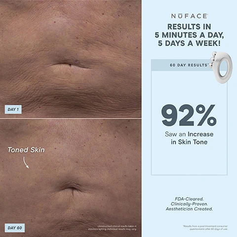 Image 1, results in 5 minutes, 5 days a week. fay 1 vs day 60 toned skin. unretouched clinical results taken in standard lighting individual results may vary. 60 day results, 92% saw an increase in skin tone. FDA cleared, clinically proven, aesthetician created. results from post treatment consumer questionnaire after 60 days of use. image 2, 1 device, fully body sculpting. 4 spheres smooths larger surface areas. 3 intensity levels. charging outlet. microcurrent technology perfect for = non invasive body toning. FDA cleared clinically proven aesthetician created. image 3, results in 5 minutes a day, 5 days a week. 60 day results, 84% saw firmer skin. day 1 vs day 60 firmer skin. unretouched clinical results taken in standard lighting, individual results may vary. FDA cleared, clinically proven, aesthetician created. results from post treatment consumer questionnaire after 60 days of use. image 4, results in 5 minutes, 5 days a week. day 1 vs day 60 smoother skin. unretouched clinical results taken in standard lighting individual results may vary. 60 day results, 80% saw smoother skin. FDA cleared, clinically proven, aesthetician created. results from a post consumer questionnaire after 60 days of use. image 5, 1 device, full body sculpting. includes = includes aqua gel activator a must have conduct microcurrent. charging cord. FDA cleared, clinically proven, aesthetician created. image 6, sculpt your body in 5 minutes. step 1 prep = cleanse with an oil free cleanser spray supercharged ionplex mist onto dry skin. step 2 = activate apply aqua gel activator to your treatment area in sections. step 3 = sculpt, glide and hold your nuBODY device over the treatment area for 5 minutes.