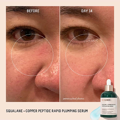 Image 1 - Image shows a side-by-side comparison of a persons face before and after using Squalane + Copper Peptide Rapid Plumping Serum, with noticeable improvement in the area around the eyes after 14 days; the text includes BEFORE and DAY 14 above each image and SQUALANE + COPPER PEPTIDE RAPID PLUMPING SERUM along with branding details at the bottom.
Image 2 - Image shows a comparison of a forehead before and after using a serum, with visible wrinkles in the before photo and reduced lines in the day 28 photo, along with the text BEFORE and DAY 28, and the product description SQUALANE + COPPER PEPTIDE RAPID PLUMPING SERUM.
Image 3 - Image shows a bottle of Biossance Squalane + Copper Peptide Rapid Plumping Serum on a light blue background, with text indicating 100% showed an instant boost of hydration in skin immediately, 97% noticed a visible improvement in skin firmness & elasticity after 1 week, and 100% demonstrated a reduction in fine lines & wrinkles after 4 weeks, along with small footnotes regarding the studies.
Image 4 - Image shows four skincare serums from Biossance displayed on a light background; they are labeled as follows: THE TOTAL LIFT with a description Visibly firms, lifts, and sculpts your skin, THE POWER PLUMPER with Plumps and replenishes moisture, THE POWER VANISHER featuring Targets dark spots and brightens, and THE ULTIMATE SMOOTHER with Exfoliates away dull skin.
Image 5 - Bottles of Biossance Squalane + Copper Peptide Rapid Plumping Serum are arranged on a light blue surface, with text stating 1200+ ★★★★★ REVIEWS and three user testimonials about the serums effectiveness.