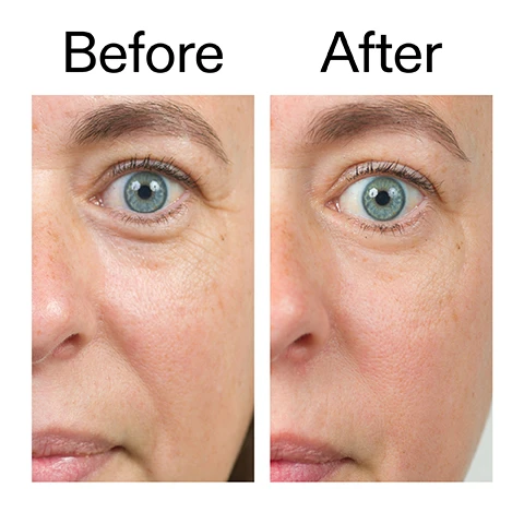 Image 1 - Close-up before and after comparison of a womans face showing her right eye and cheek, with visible wrinkles on the left and significantly smoother skin on the right, labeled Before and After. Image 2 - A close-up of a persons face looking up with their hand touching their cheek is shown next to text that reads: Clinically proven to strengthen the skins barrier from first use* Clinically proven to firm, plump and visibly lift in 28 days* Clinically proven to visibly reduce fine lines and wrinkle depth in 4 weeks* *4-week clinical study of 20 people. Image 3 - A close-up of a persons eyes smiling, showing prominent wrinkles around the eyes and nose, with visible text reading Why we love it followed by Rich, non-greasy formula, Smooths, firms and deeply hydrates, and Strengthens the barrier and helps shield against signs of ageing. Image 4 - A white swatch of creamy product on a clean background, with the text Why it works Bio-Active Ceramide NP STRENGTHENS THE BARRIER. FIRMS AND SMOOTHS. 5% Gransil Blur X-11™ INSTANTLY BLURS THE LOOK OF FINE LINES. Image 5 - White creamy product swirled on a white background with text that reads How to layer your routine and a numbered list: 1 CLEANSE, 2 HYDRATE, 3 TREAT, 4 MOISTURISE, 5 SPF. Image 6 - A persons hands hold an open white jar of THE INKEY LIST moisturizer with a black lid, revealing the white cream inside, next to usage instructions: How to use USE AM + PM. BLUEBERRY-SIZED AMOUNT. MASSAGE ONTO FACE AND NECK. USE BEFORE SPF IN THE AM AND AS THE FINAL STEP IN THE PM. The product label also reads: THE INKEY LIST BIO-ACTIVE CERAMIDE REPAIRING AND PLUMPING MOISTURIZER Visibly smooths and firms skin, whilst strengthening skin barrier 1.7 US fl.oz / 50ml e. Image 7 - A womans face with hands touching her cheeks, looking upwards, appears below the text Clinically proven to firm, plump and visibly lift* and the fine print *4 week clinical study of 20 people.