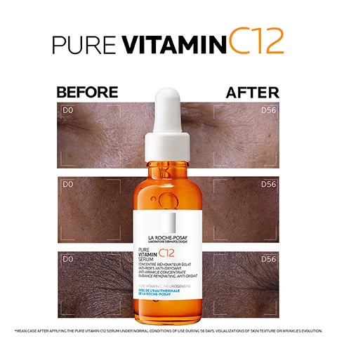 Image 1 - Image shows a side-by-side comparison of skin before and after using a serum, with an orange dropper bottle labeled LA ROCHE-POSAY PURE VITAMIN C12 SERUM positioned in the center, along with the text BEFORE and AFTER; visual notes indicate changes in skin texture and wrinkles over 56 days.
Image 2 - Image of a dropper bottle containing an orange serum, with text that says BOOST SKIN RADIANCE REDUCES THE APPEARANCE OF WRINKLES.
Image 3 - A brown serum bottle with a dropper cap is shown, next to bold text stating new formula now with 12% pure vitamin C, 93% of women see an improvement in radiance, and 71% of women see an improvement of skin tone evenness.
Image 4 - A hand gently touches the dropper of a brown serum bottle labeled La Roche-Posay Pure Vitamin C12 Serum, with the text APPLY IN THE MORNING AND NIGHT TO THE FACE prominently displayed.
Image 5 - An orange bottle of La Roche-Posay Pure Vitamin C12 Serum is displayed against a background of various skin tones, with text stating PURE VITAMIN C12 SERUM FOR ALL SKIN TONES.
Image 6 - A triptych showcasing three skincare ingredients with abstract textures: the first panel features multicolored patterns labeled Pure Vit. C, the second panel displays crystalline structures labeled Salicylic Acid, and the third panel contains blue droplets labeled Neuro Sensine, with descriptive text about their benefits.
Image 7 - Image shows two skincare products from La Roche-Posay: an orange bottle of Pure Vitamin C12 Serum on the left with text that reads BOOSTS SKIN RADIANCE REDUCES THE APPEARANCE OF WRINKLES, and a white bottle of Anthelios UVMUNE 400 Daily Sun Protection on the right with text stating THE MOST EFFICIENT UV FILTER VERY HIGH UVB AND ULTRA LONG UVA DAILY SUN PROTECTION FOR FACE.
Image 8 - Image shows two skincare products from La Roche-Posay: a dropper bottle of Pure Vitamin C12 Serum on the left and a tube of Anthelios UVMune 400 sunscreen on the right, with instructions: 1 APPLY 3-4 DROPS ON FACE AND NECK AFTER CLEANSING, 2 APPLY TO FACE AND NECK REAPPLY EVERY 2H.